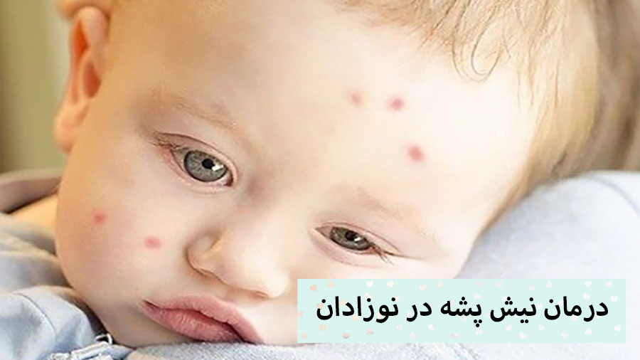درمان نیش پشه در نوزادان