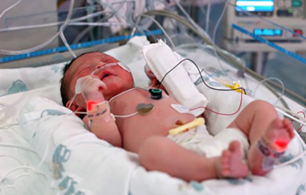مراقبت از نوزاد نارس در بیمارستان