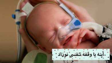 تصویر آپنه نوزاد یا وقفه تنفسی در خواب را چگونه می توان تشخیص داد؟